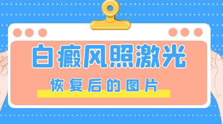 诊断治疗-治疗白癜风心理调解很重要